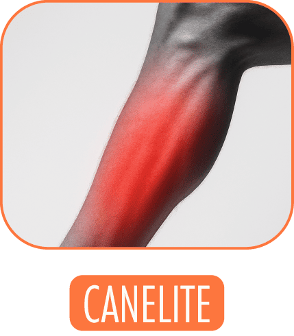 Canela com dor (Canelite)